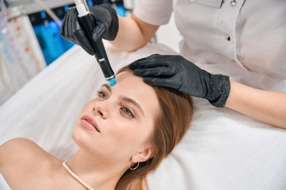 Microneedling Facial