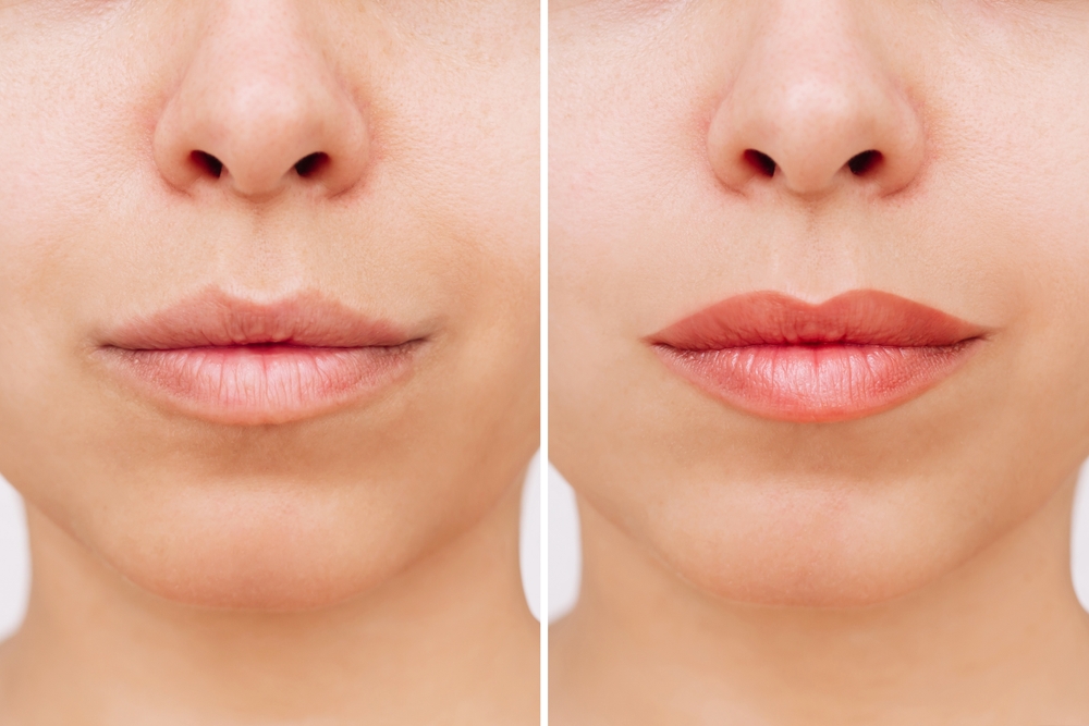 Lip Blush Brand Partnership